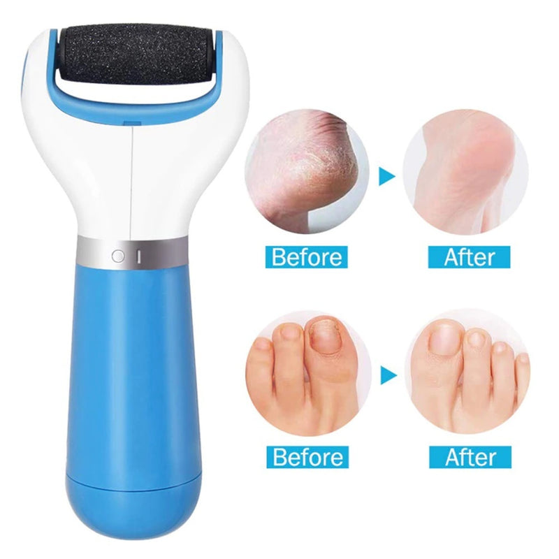 Esfoliador Lixador Ralador de Pé Rápido Removedor de Calos Lixa Elétrica USB